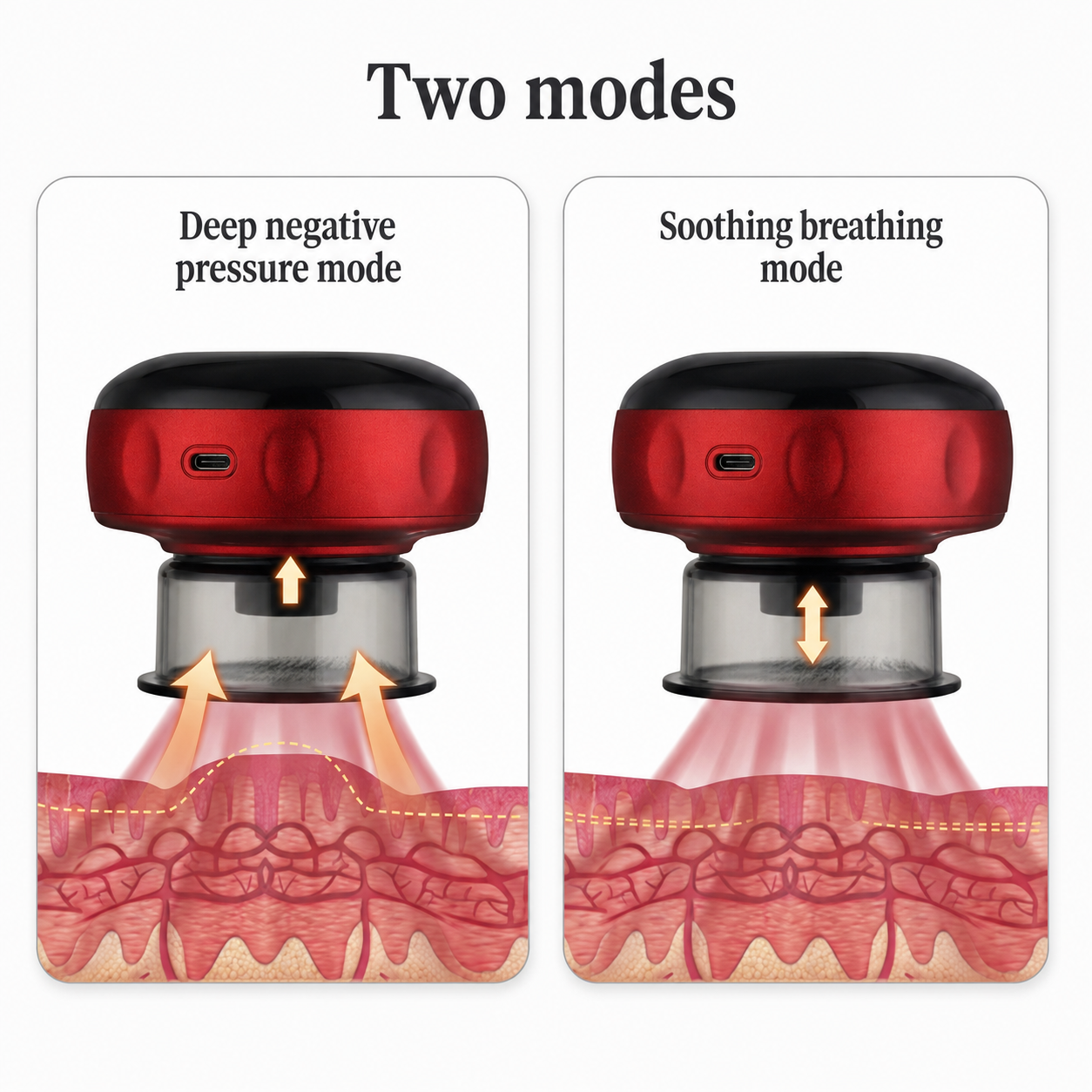 Wireless Heated Cupping Device